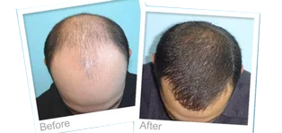  | Rupam Clinic before after