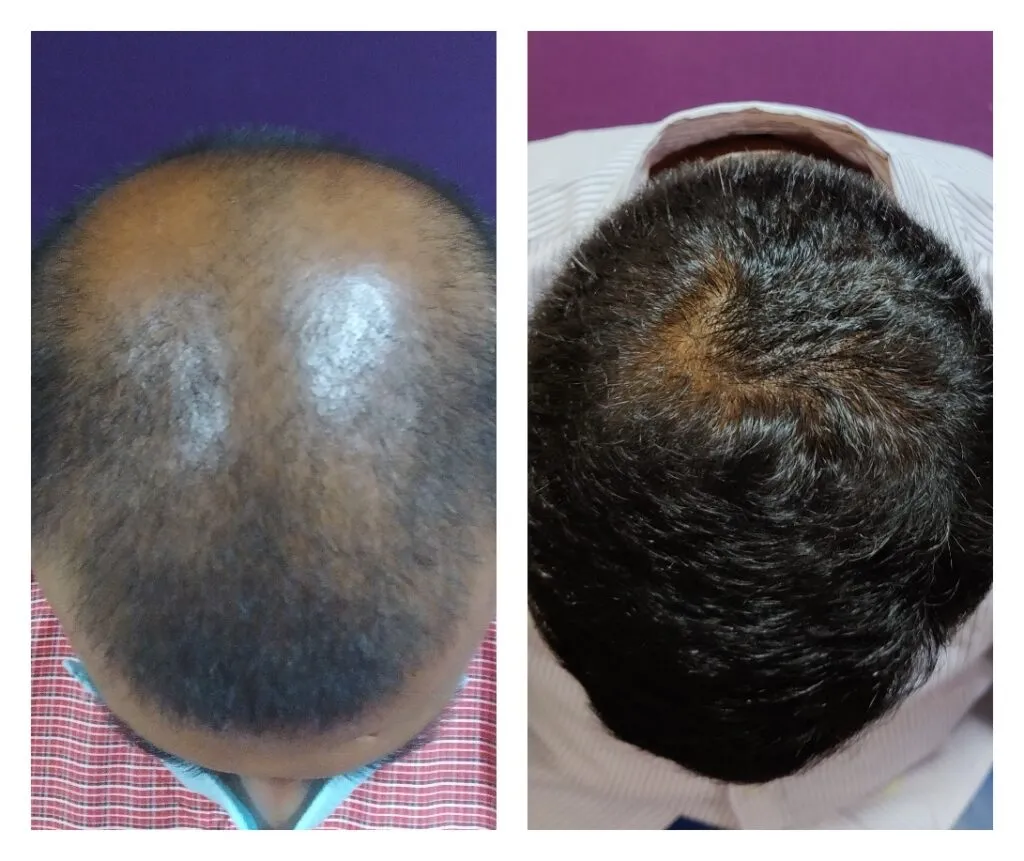  | Rupam Clinic before after