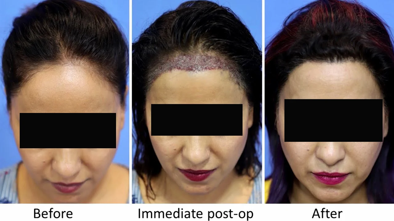  | Rupam Clinic before after