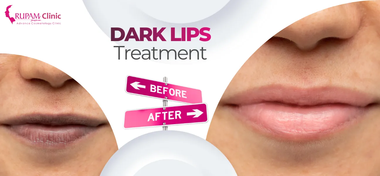 Say Goodbye to Dark Lips: Discover The Most Efficient Natural and Best Dark Lips Treatments!