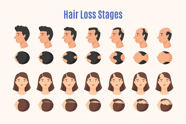 Hair Loss Stages of Male and Female | Rupam Clinic