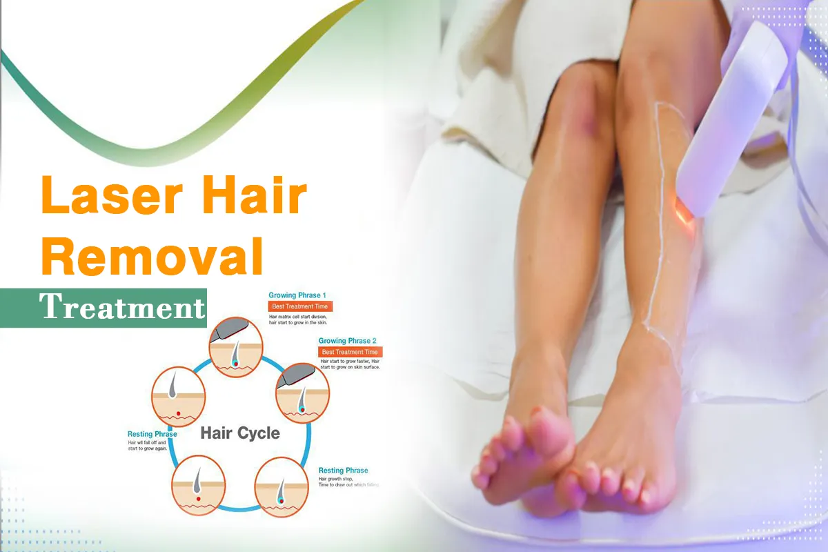 Laser Hair Removal Treatment