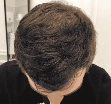 Before