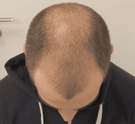 After